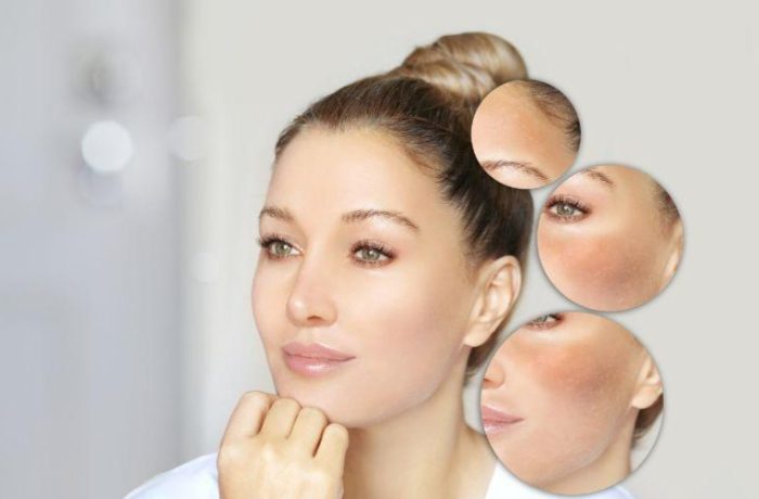 10 Benefits of Using Glutathione Supplements for Skin Whitening