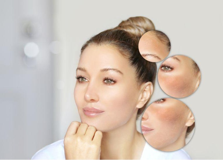 10 Benefits of Using Glutathione Supplements for Skin Whitening